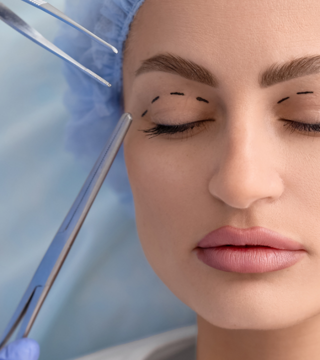 What does healing feel like after blepharoplasty?