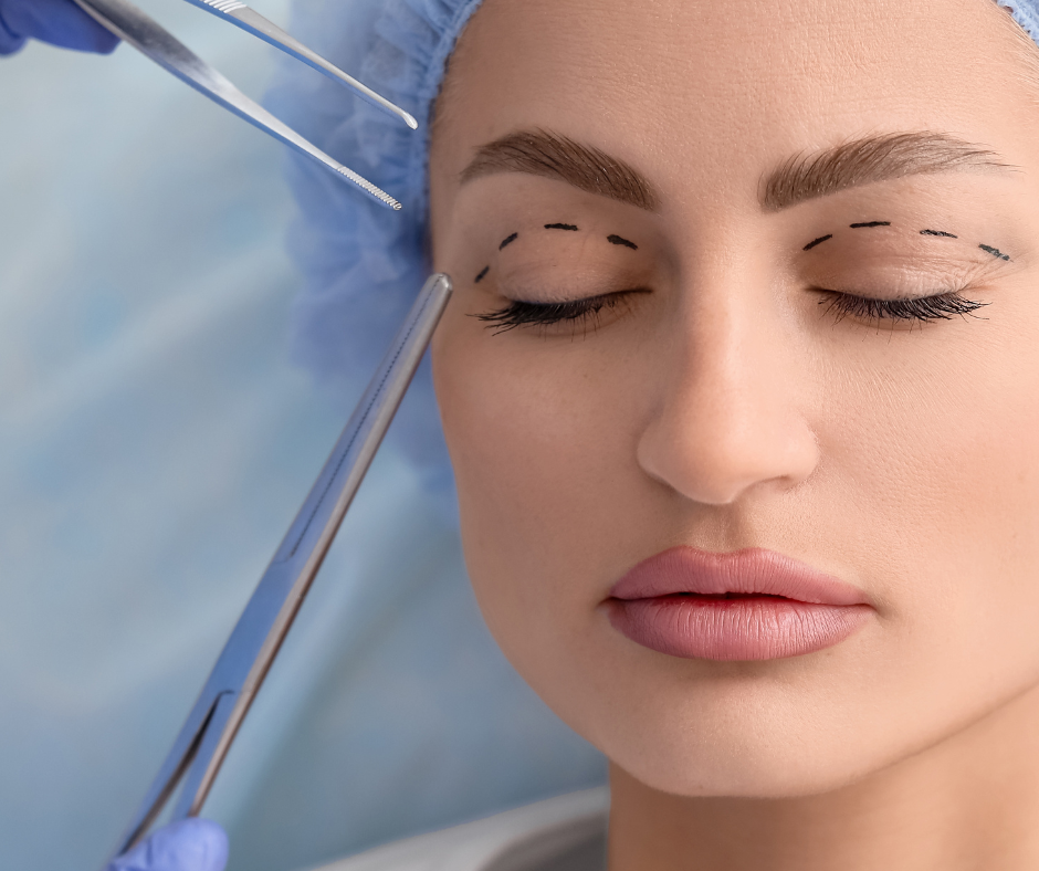 What does healing feel like after blepharoplasty?