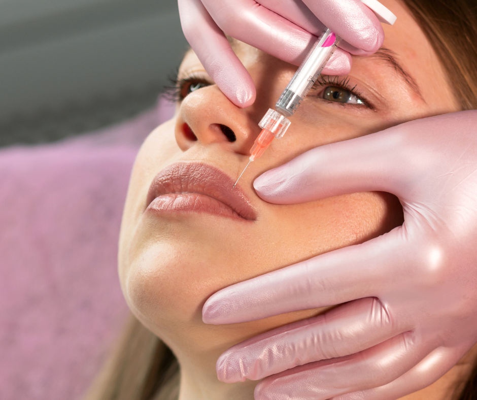 What To Expect After Fillers