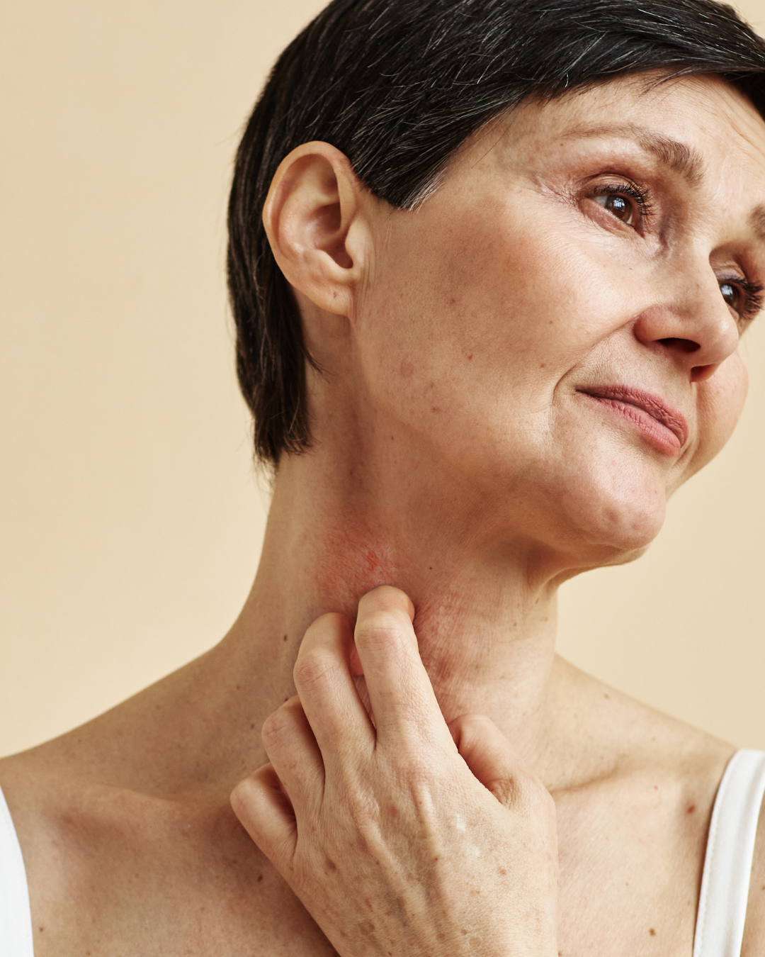 womans allergic reaction