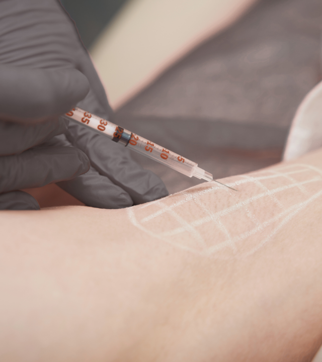 excessive sweating treatment