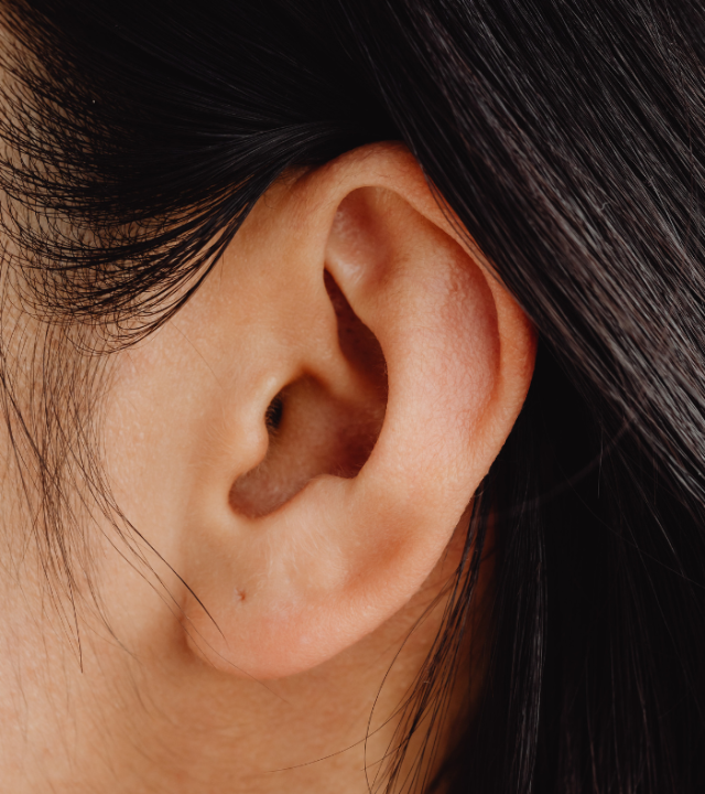 What is The Recovery Time For Earlobe Reduction?