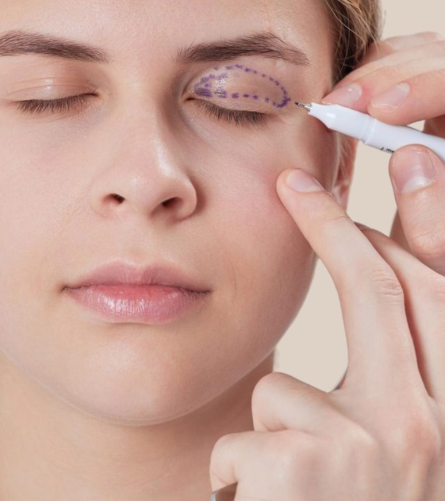 What Is Blepharoplasty and How Does It Work?