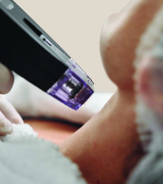 Can Morpheus8 Lift Sagging Skin?