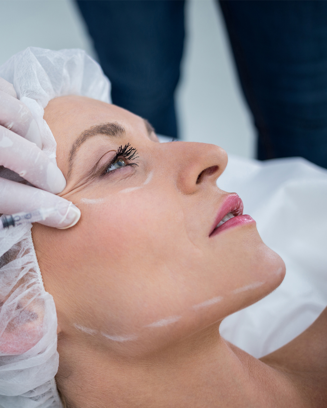 What is Rejuran treatement?