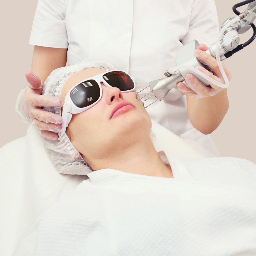 Can CO2 Laser Remove Acne Scars?