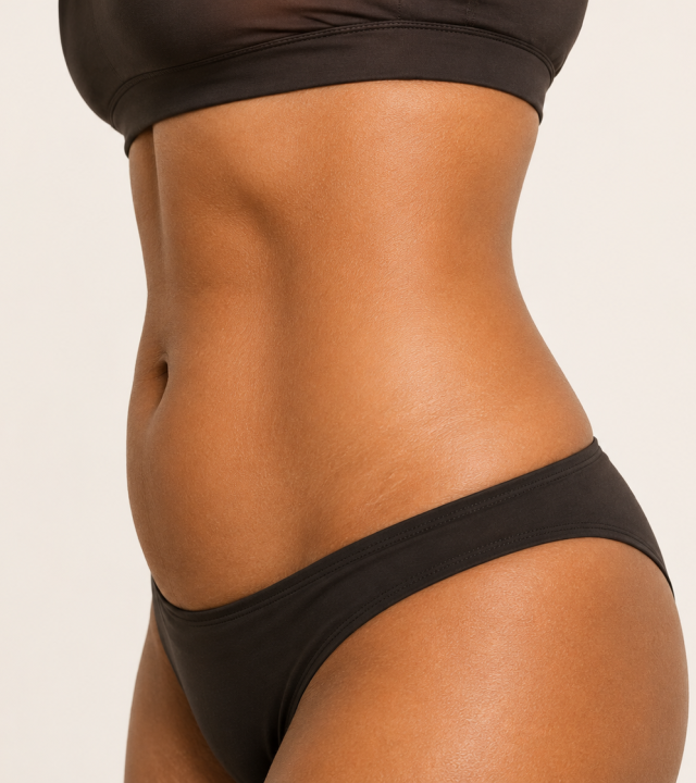 Can BodyTite Replace a Tummy Tuck?